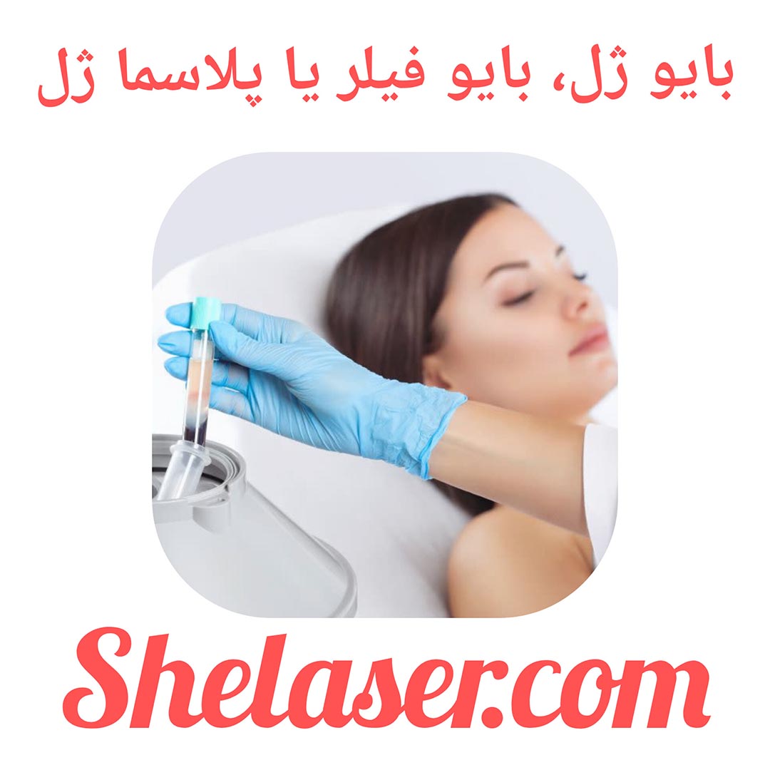 بایو ژل، بایو فیلر یا پلاسما ژل