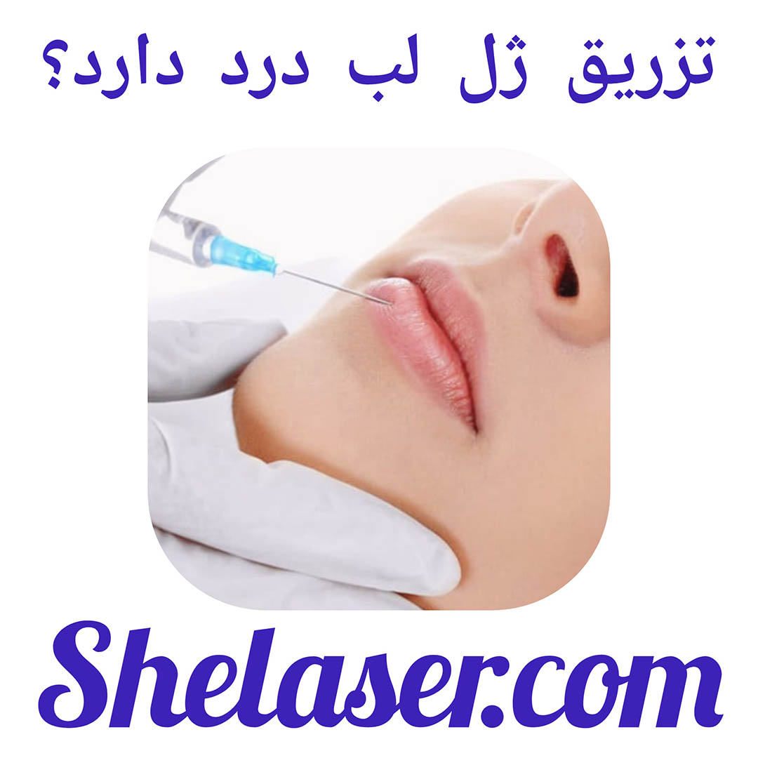 تزریق ژل لب درد دارد؟