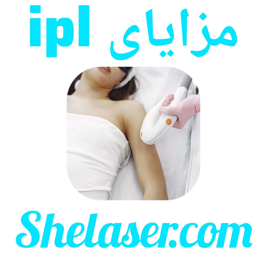 مزایای ipl