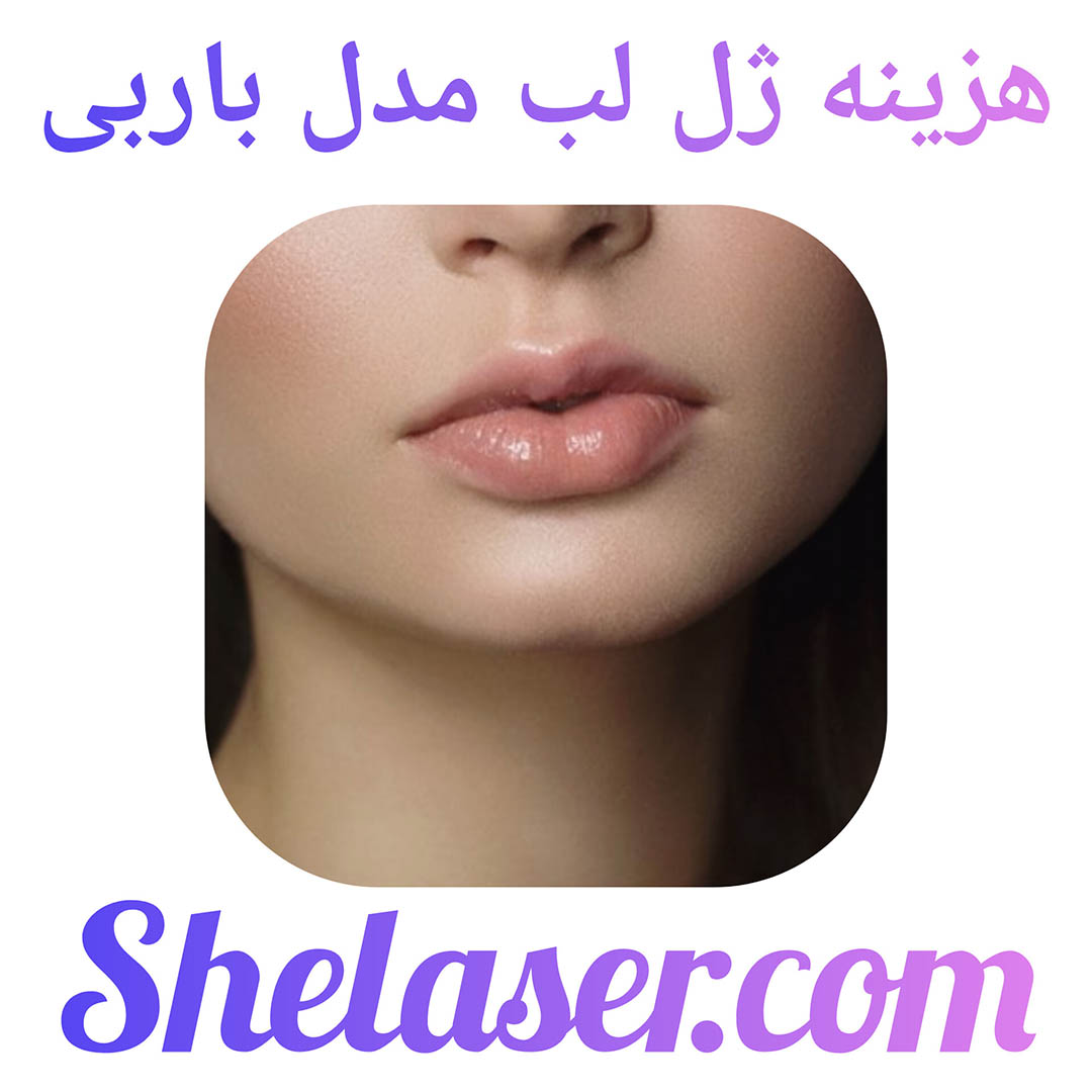 هزینه ژل لب مدل باربی