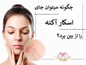 چگونه میشود جای اسکار را از بین برد