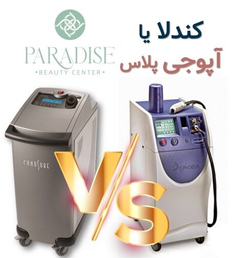 تفاوت آپوجی و کندلا