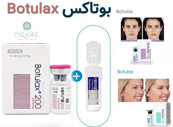 بوتاکس بوتولاکس