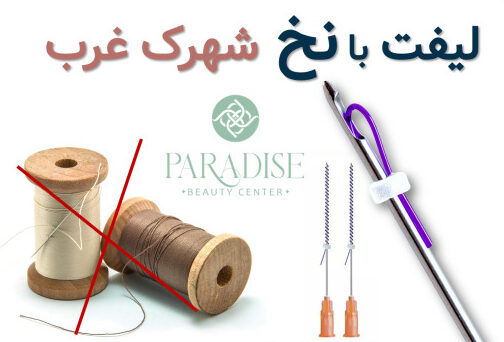 لیفت با نخ