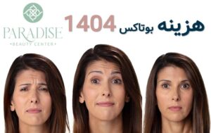 هزینه بوتاکس 1404