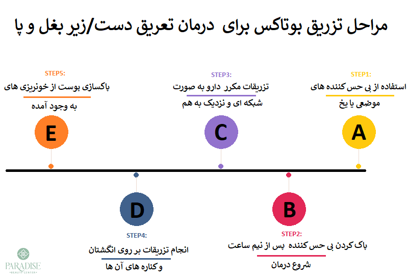 مراحل تزریق بوتاکس برای درمان تعریق دست/زیر بغل و پا