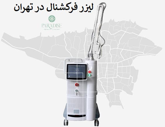 لیزر فرکشنال در تهران