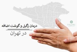 درمان زگیل و گوشت اضافه در تهران