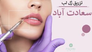 تزریق ژل لب سعادت آباد