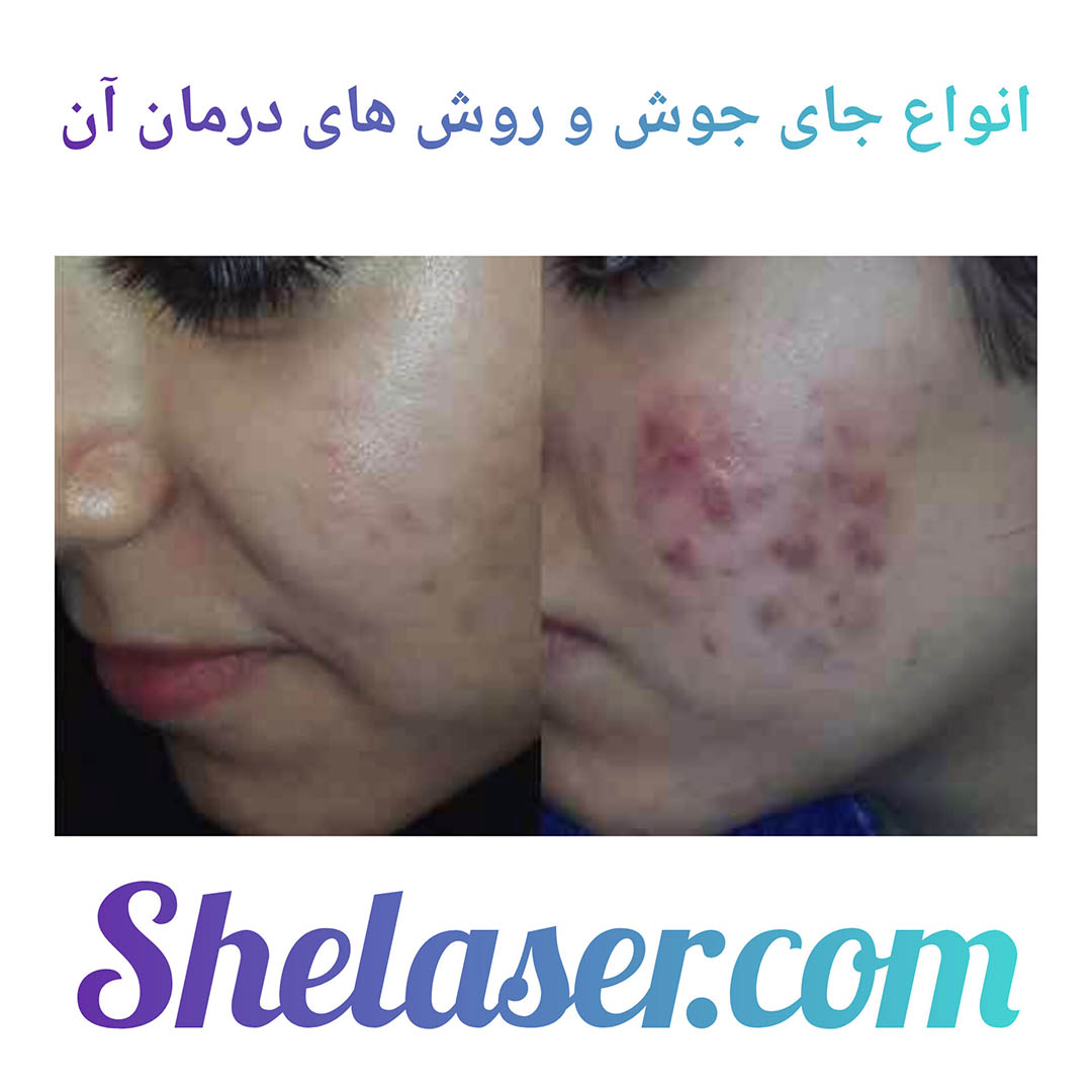 مقایسه اسکار آیس‌پیک، باکس‌کار و رولینگ