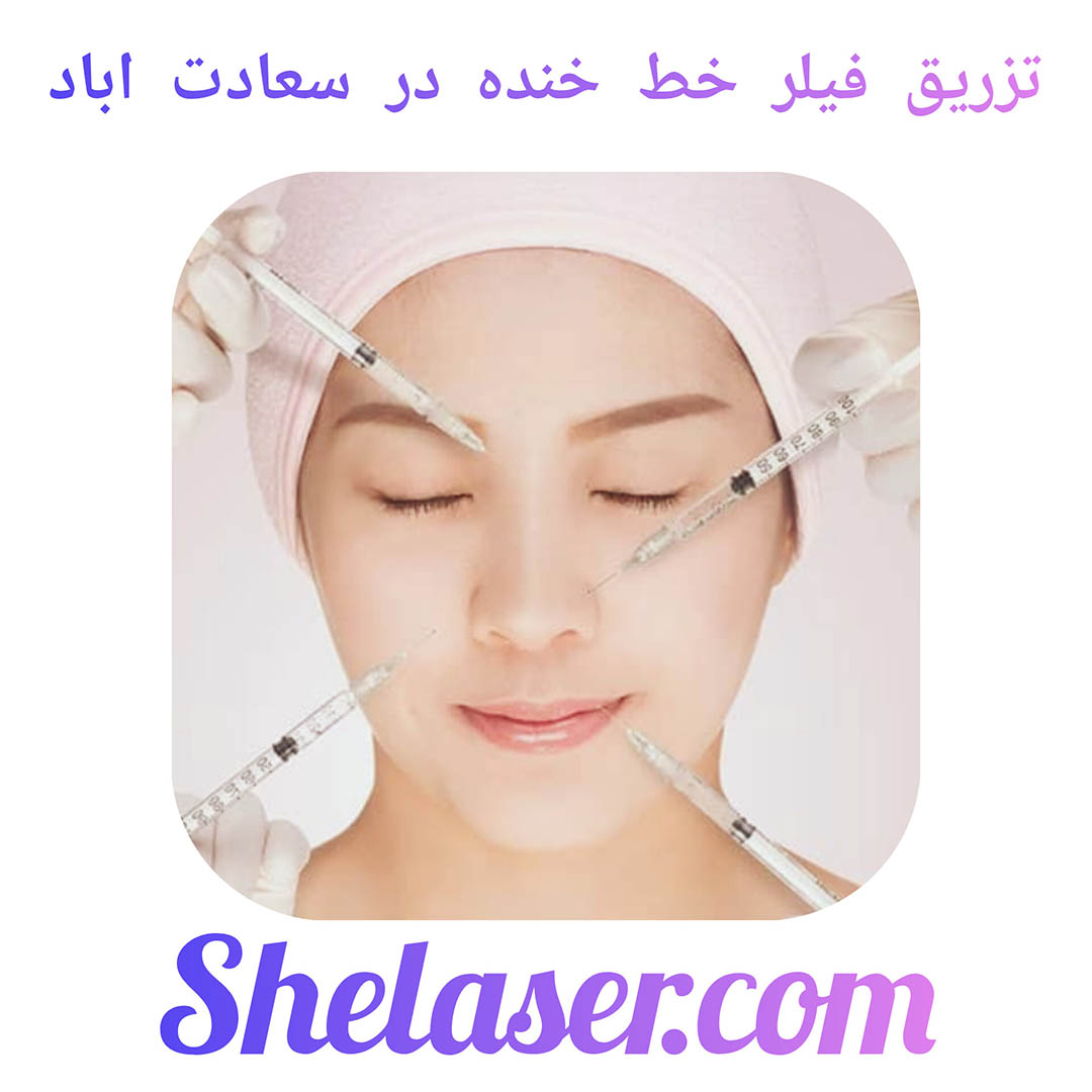 تزریق فیلر خط خنده در سعادت اباد