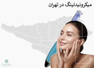 میکرونیدلینگ در تهران