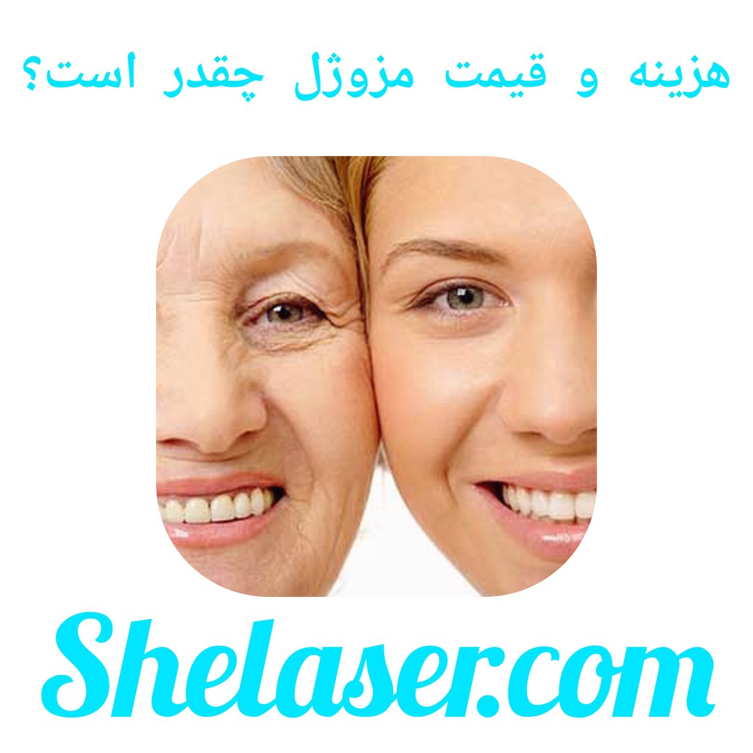 هزینه و قیمت مزوژل چقدر است؟