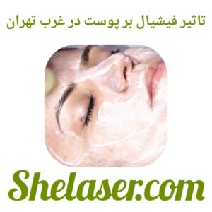 فیشیال در تهران