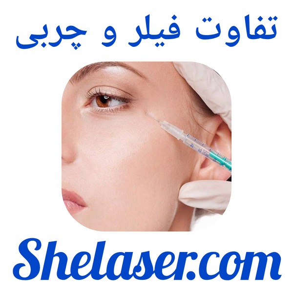 تفاوت فیلر و چربی