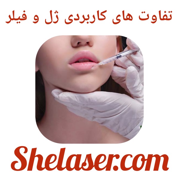 تفاوت های کاربردی ژل و فیلر