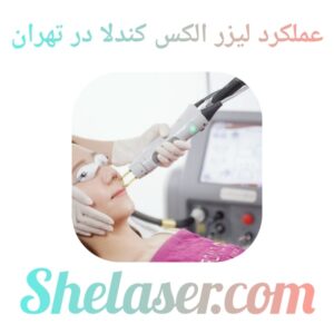 الکس کندلا در تهران