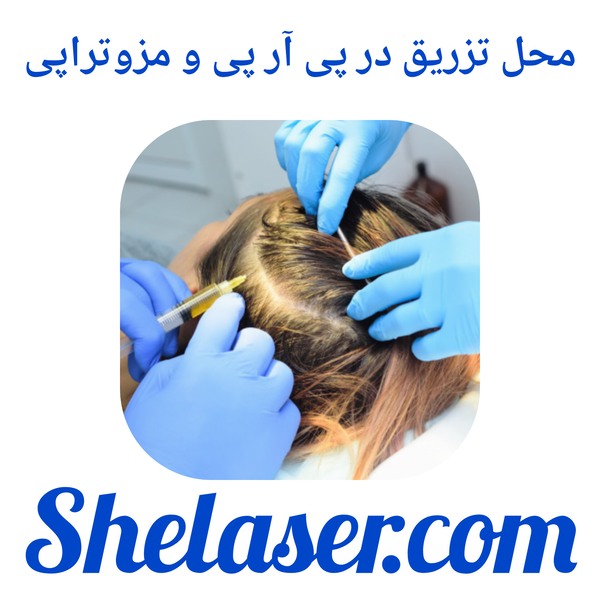 محل تزریق در پی آر پی و مزوتراپی