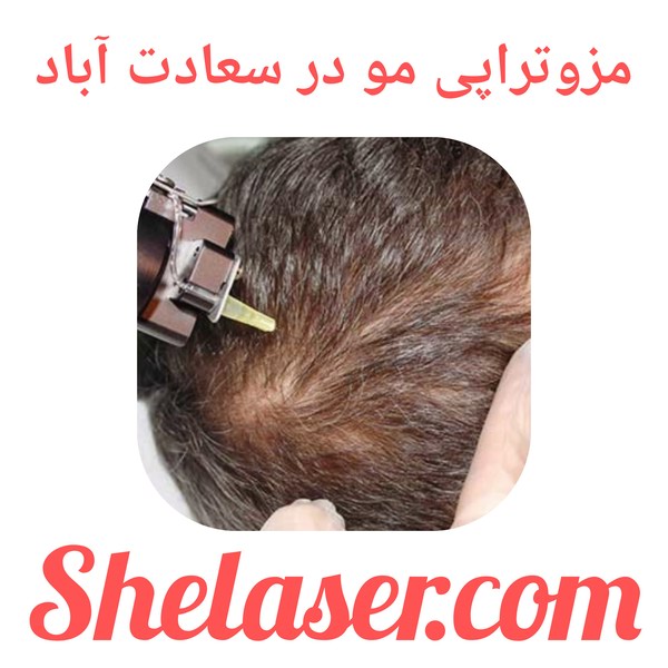 مزوتراپی مو در سعادت آباد