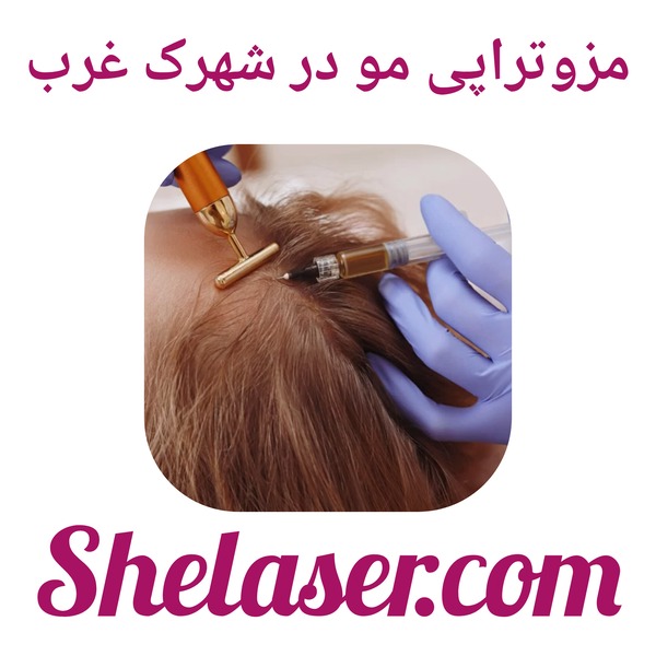 مزوتراپی مو در شهرک غرب