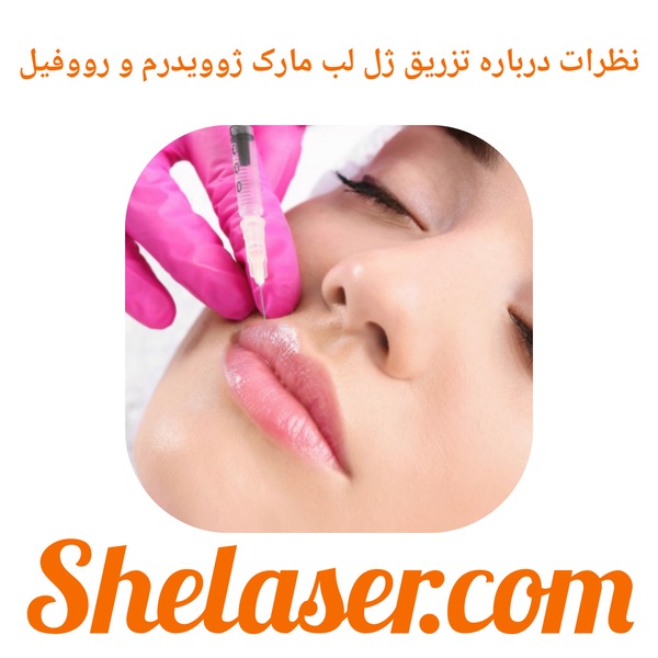 نظرات درباره تزریق ژل لب مارک ژوویدرم و رووفیل