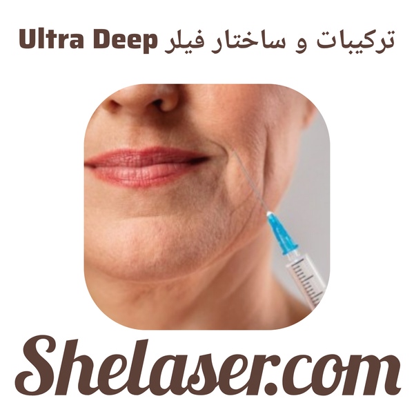 ترکیبات و ساختار فیلر Ultra Deep