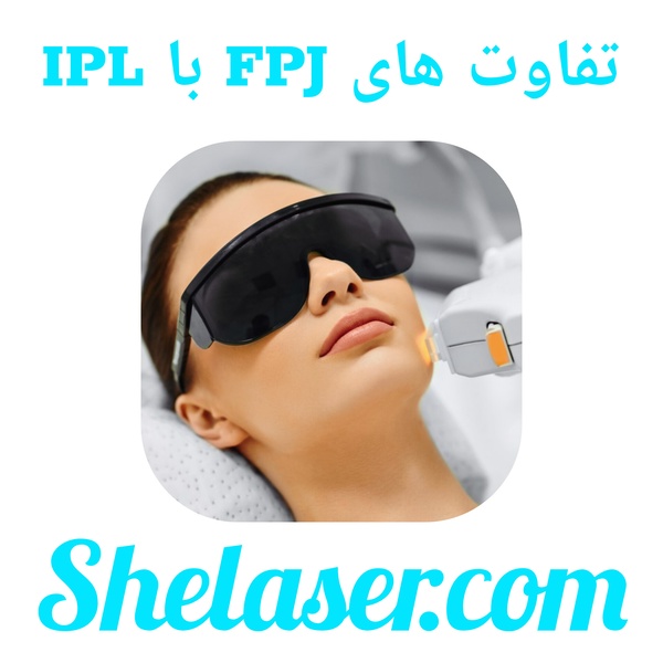 تفاوت‌های FPJ با IPL