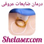 درمان ضایعات عروقی