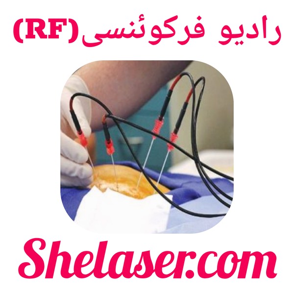 رادیو فرکوئنسی (RF)