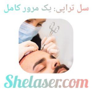 سل تراپی: یک مرور کامل