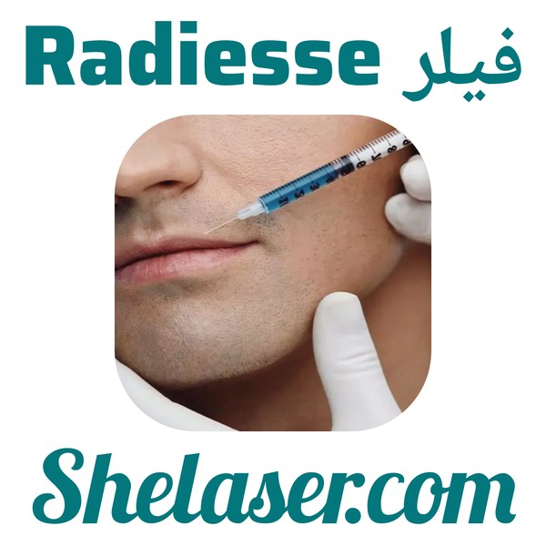 فیلر Radiesse