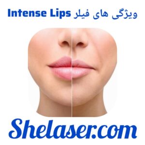 ویژگی‌های فیلر Intense Lips