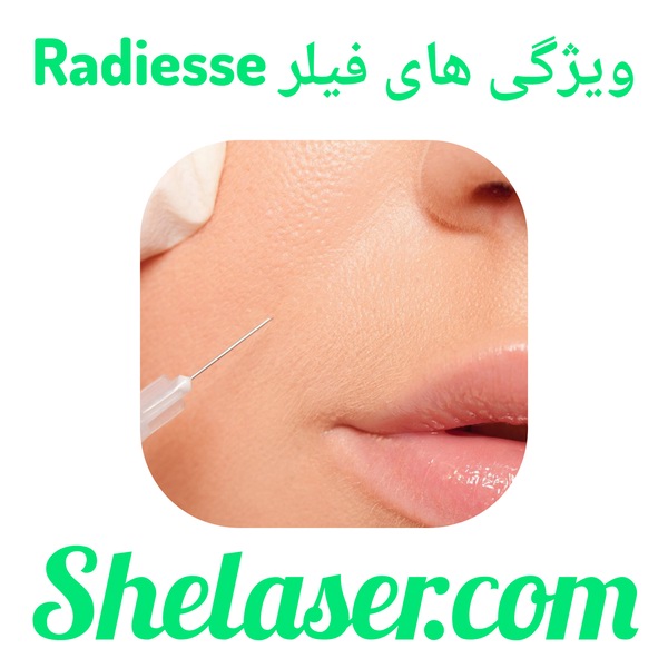 ویژگی‌های فیلر Radiesse