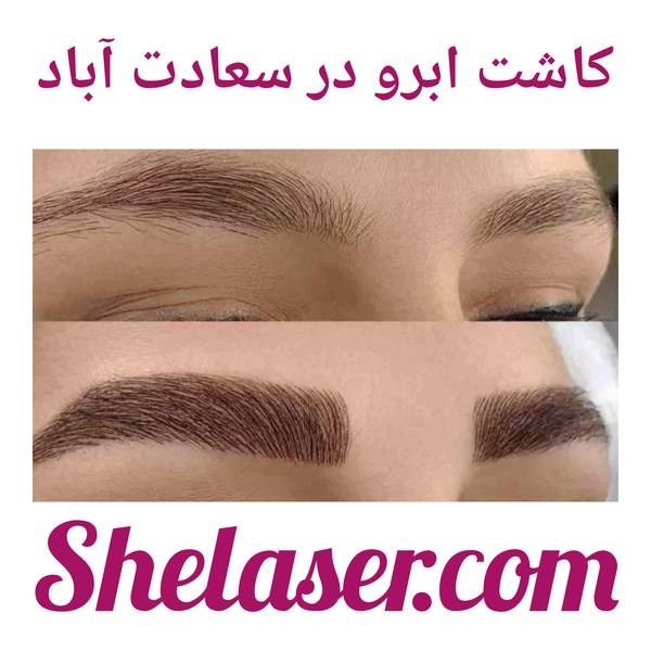 کاشت ابرو در سعادت آباد