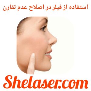 استفاده از فیلر در اصلاح عدم تقارن