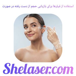 استفاده از فیلرها برای بازیابی حجم از دست رفته در صورت