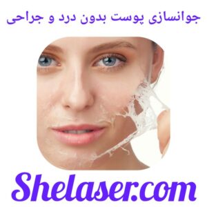 جوانسازی پوست بدون درد و جراحی