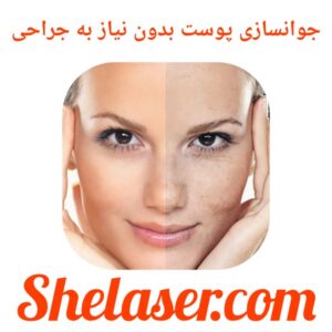 جوانسازی پوست بدون نیاز به جراحی