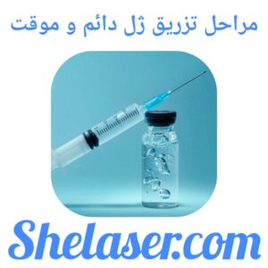 مراحل تزریق ژل دائم و موقت