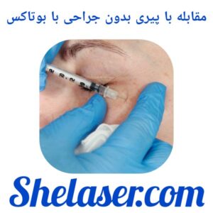 مقابله با پیری بدون جراحی با بوتاکس