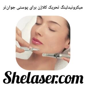 میکرونیدلینگ تحریک کلاژن برای پوستی جوان‌تر