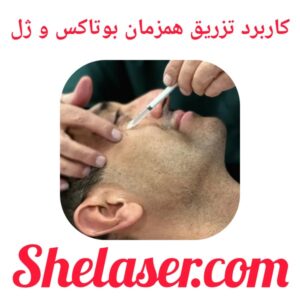 کاربرد تزریق همزمان بوتاکس و ژل