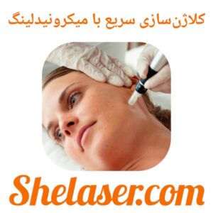 کلاژن‌سازی سریع با میکرونیدلینگ