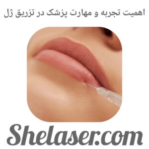 اهمیت تجربه و مهارت پزشک در تزریق ژل