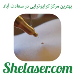 بهترین مرکز کرایوتراپی در سعادت آباد