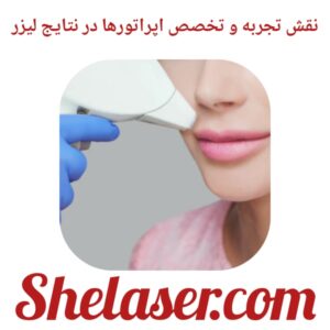 نقش تجربه و تخصص اپراتورها در نتایج لیزر