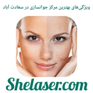 ویژگی‌های بهترین مرکز جوانسازی در سعادت‌آباد