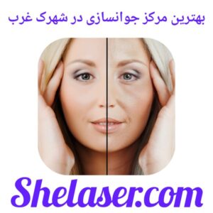 بهترین مرکز جوانسازی در شهرک غرب