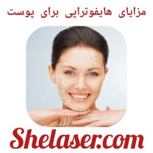 مزایای هایفوتراپی برای پوست