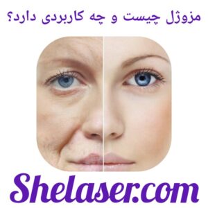 مزوژل چیست و چه کاربردی دارد؟